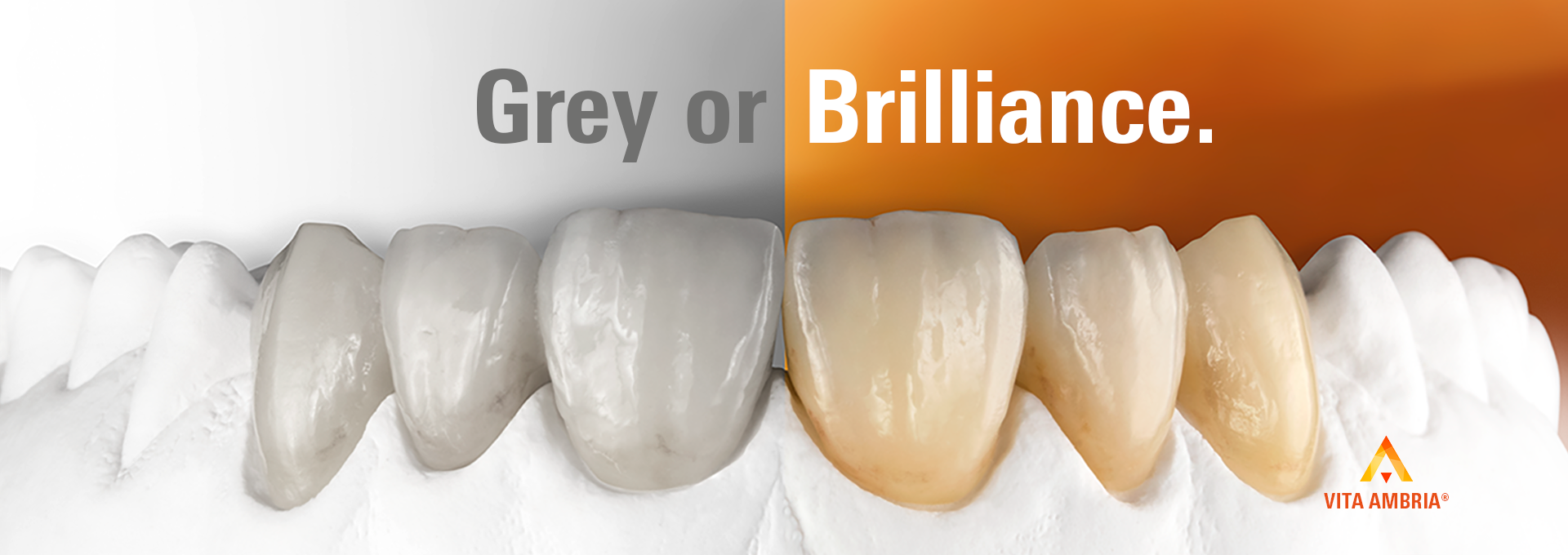 VITA AMBRIA Presskeramik Pellet und Frontzahnkronen auf Modell