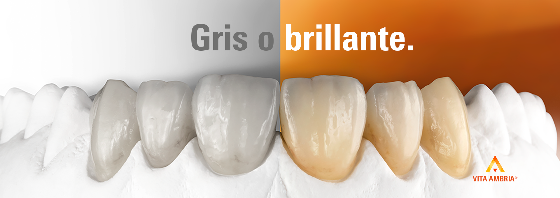 Pastilla de cer&aacute;mica prensada VITA AMBRIA y coronas anteriores en el modelo