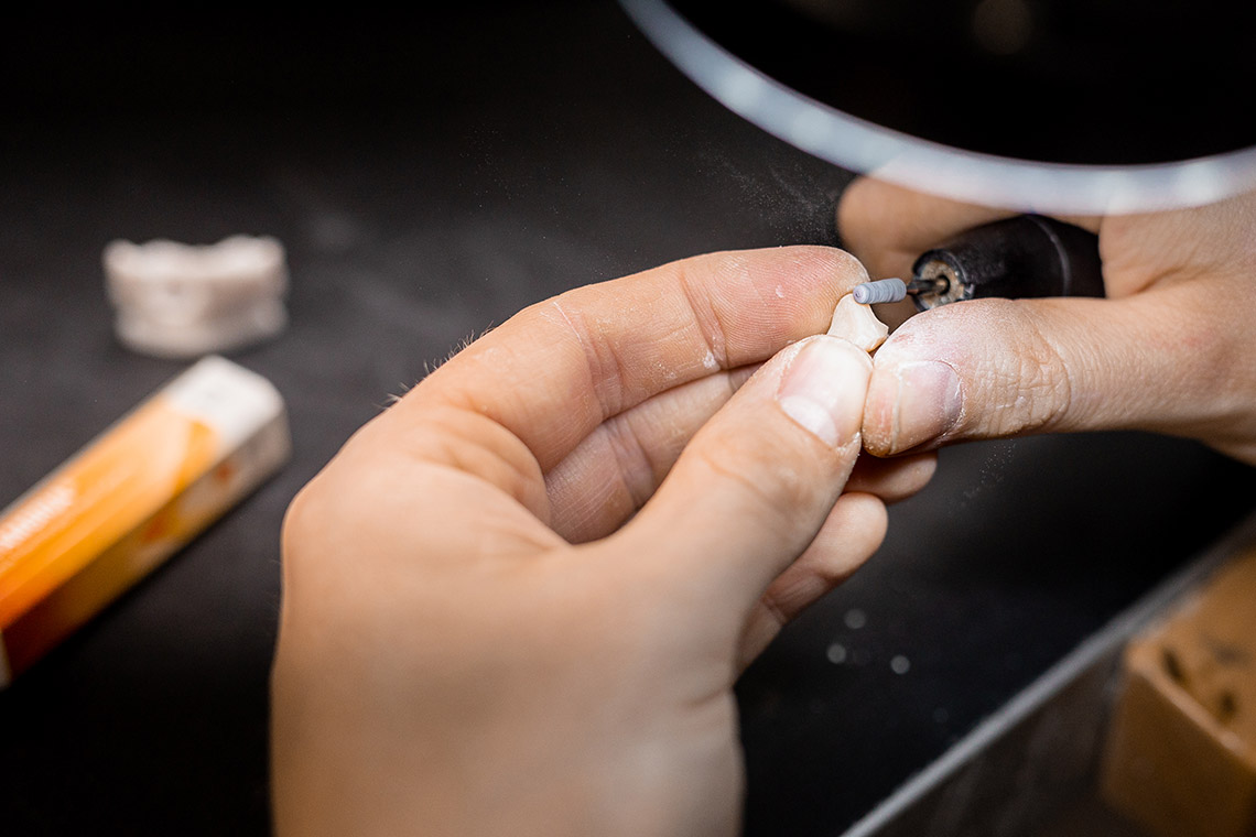 Acabado de una restauraci&oacute;n de cer&aacute;mica prensada