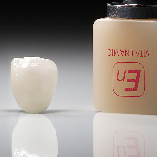 Las carillas ya acabadas, poco antes de la prueba cl&iacute;nica en boca.