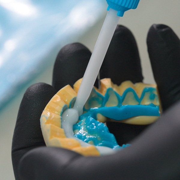 Se aplic&oacute; en la llave de silicona un composite fluido para pr&oacute;tesis provisionales para confeccionar un mock-up.