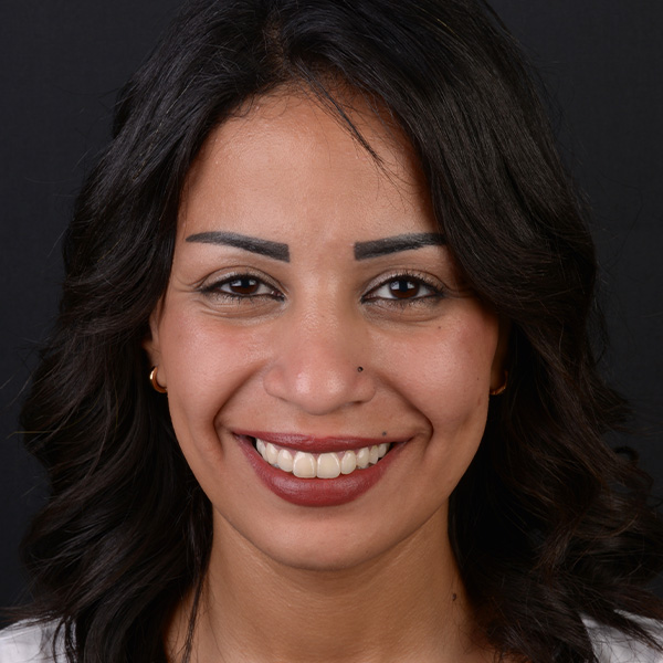 La rehabilitaci&oacute;n est&eacute;tica subrayaba la personalidad de la paciente segura de s&iacute; misma.