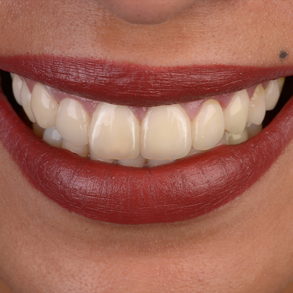 La nueva zona est&eacute;tica presentaba un juego de colores y de luces natural.