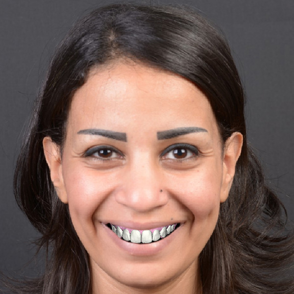 &hellip; e quindi accoppiato con una scansione intraorale &hellip;