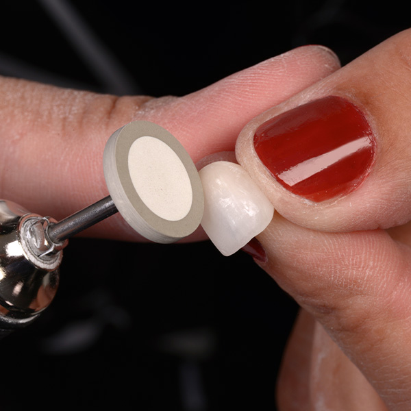 Per la finitura &egrave; stato usato il gommino a a ruota del VITA ENAMIC Polishing Set technical.