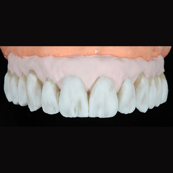 ENAMEL fog, TRANSLUCENT smoky-white im Bereich der Z&auml;hne und GINGIVA grapefruit mit ENAMEL clear im Gingivalbereich.