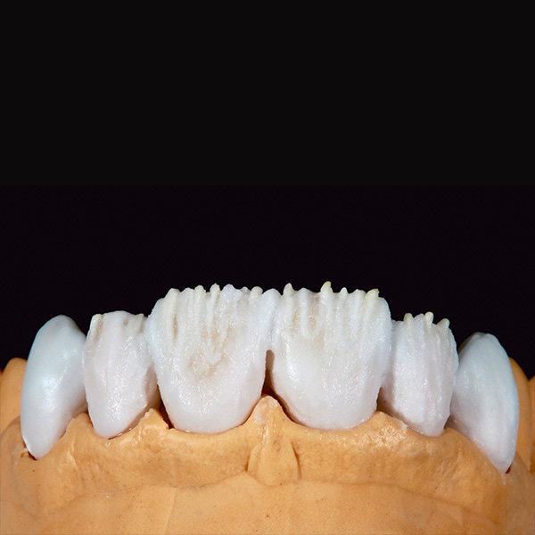 Die Mamelons wurden mit MAMELON saffron zus&auml;tzlich akzentuiert.