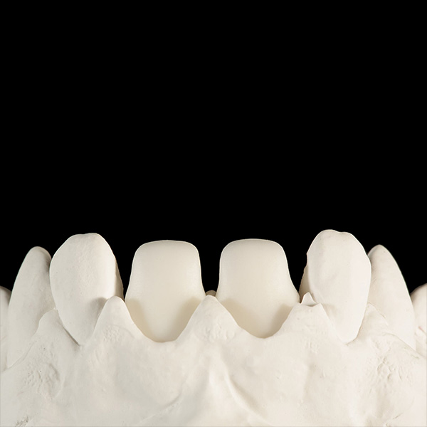 F&uuml;r einen zuverl&auml;ssigen Verbund wurden die beiden Ger&uuml;ststrukturen sandgestrahlt.