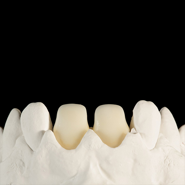 Der Washbrand mit FLUO INTENSE sand und sesame zur Unterst&uuml;tzung der Grundzahnfarbe aus der Tiefe.