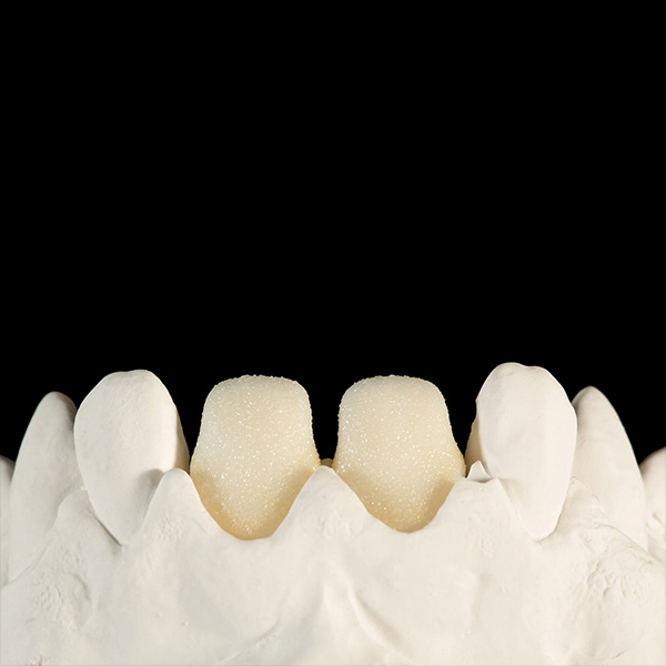 F&uuml;r einen guten Verbund wurde zus&auml;tzlich mit FLUO INTENSE arctic white best&auml;ubt.