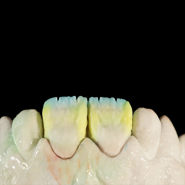 Der zus&auml;tzlich intensivierte Zervikalbereich mit TRANSLUCENT sunlight.