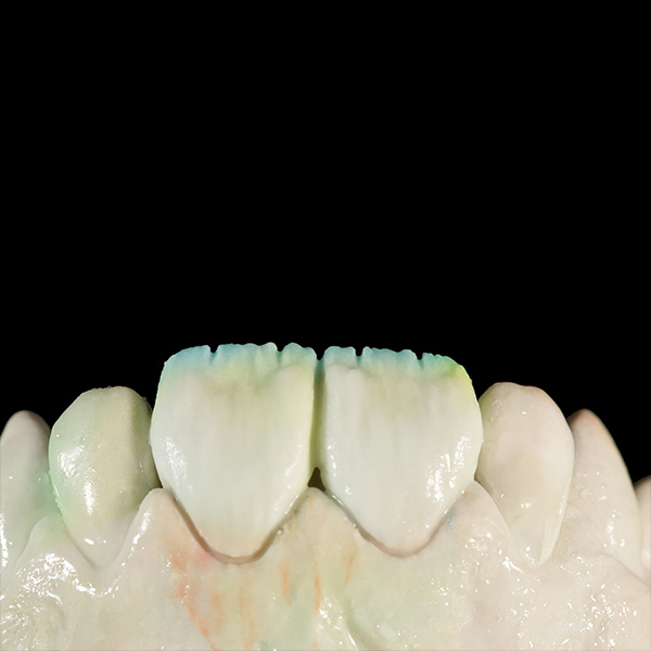 Die unteren zwei Drittel wurden abschlie&szlig;end mit ENAMEL medium &uuml;berschichtet.