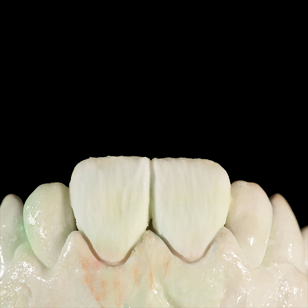 MAMELON honey und TRANSLUCENT sunlight sorgten in der Schneide f&uuml;r einen Halo-Effekt.