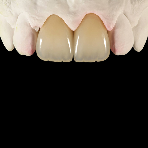 Im Auflicht zeigte sich eine lebendige und naturgetreue &Auml;sthetik.