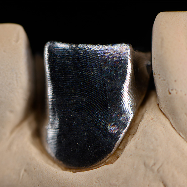 CAD/CAM-gest&uuml;tzt gefertigtes Titanger&uuml;st auf dem Modell.