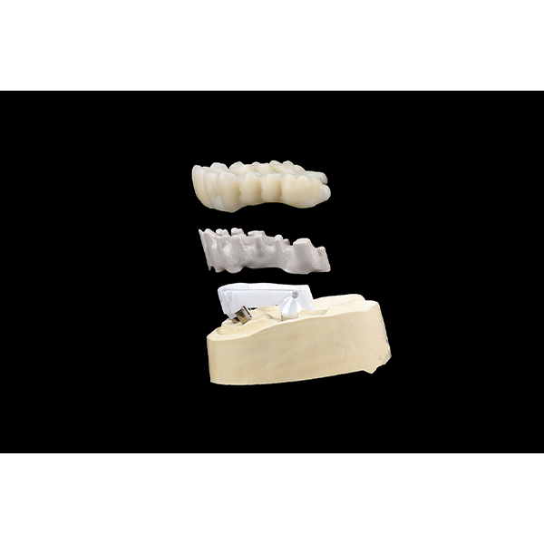 Die implantatprothetischen Komponenten passten pr&auml;zise zueinander.