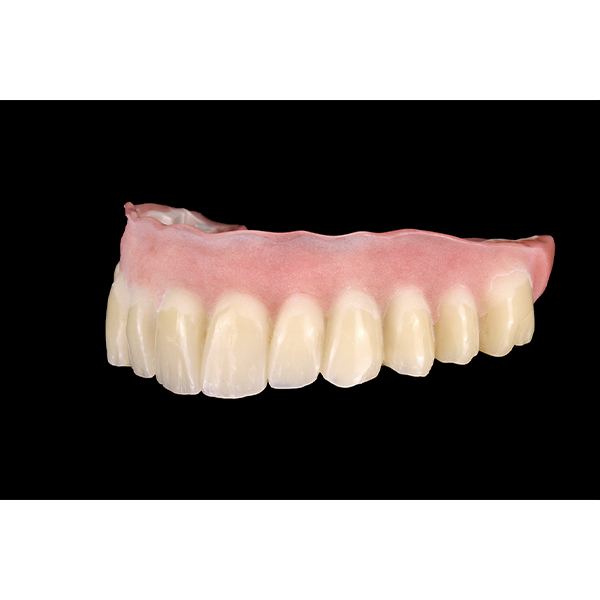 Die Basis wurde mit einem Kaltpolymerisat aufgebaut und anschlie&szlig;end f&uuml;r die Individualisierung sandgestrahlt.