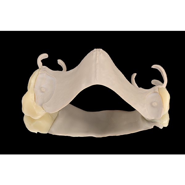 Mit dem Zahnmaterial wurden auch basale Anteile aus einem Guss gefr&auml;st.