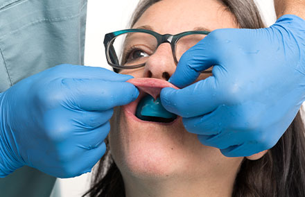 L&rsquo;assise du porte-empreinte individuel doit aussi &ecirc;tre garantie lors des mouvements muco-dynamiques.