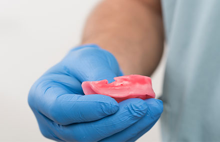 Une contre-d&eacute;pouille r&eacute;tentive a &eacute;t&eacute; int&eacute;gr&eacute; au bourrelet de cire mandibulaire pour fixer le silicone.