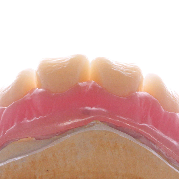 La VITAPAN montre en lumi&egrave;re r&eacute;fl&eacute;chie sa texture de surface et sa morphologie naturelles.