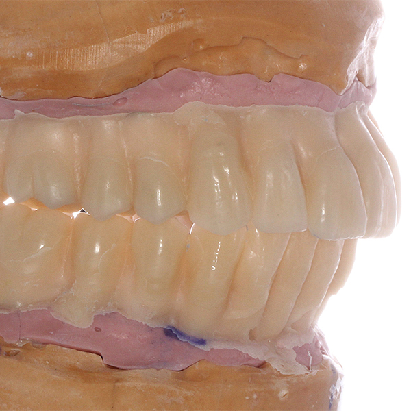 La base polym&eacute;ris&eacute;e a ensuite pu &ecirc;tre &eacute;labor&eacute;e.