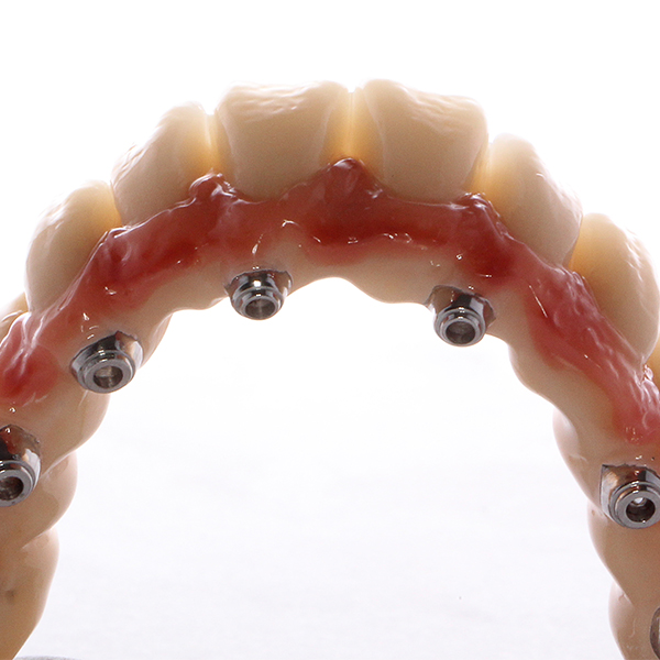 La morphologie naturelle et la texture de surface des incisives maxillaires en lumi&egrave;re r&eacute;fl&eacute;chie.