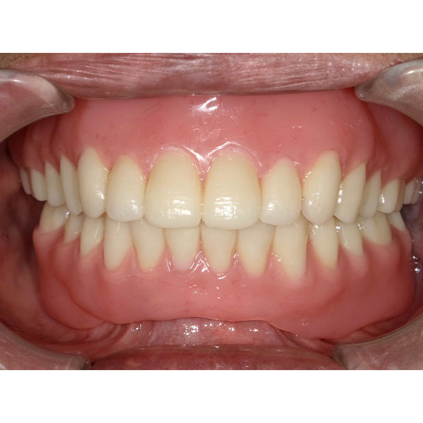 la texture de surface, ajust&eacute;e par un polissage, semblait vivante et adapt&eacute;e &agrave; l'&acirc;ge.