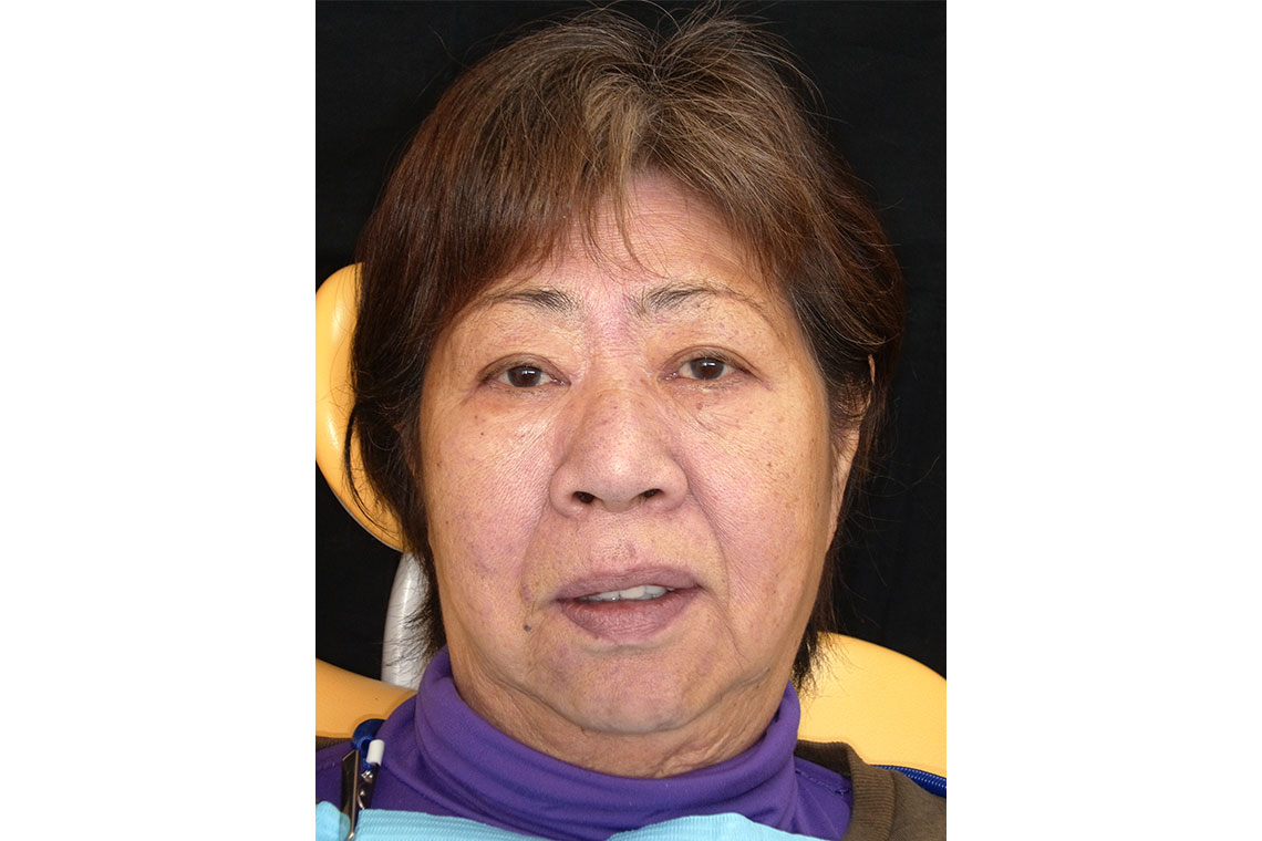 La patiente &eacute;tait satisfaite de la nouvelle r&eacute;alsiation.