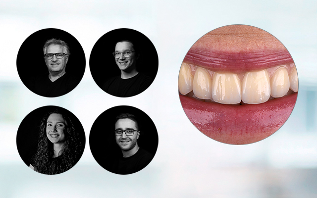 VITA YZ MULTI TRANSLUCENT