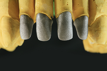 Step 2 Metallger&uuml;st