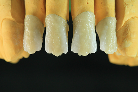 Step 5 Luminary Effekt