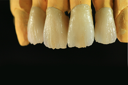 Step 7 VMK Master&reg; Keramik nach dem ersten Brand.