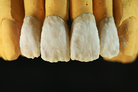 Step 8 Korrekturbrand