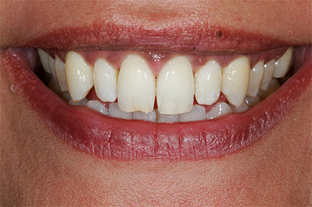 Step 1 Initial situation Step 1 Initial situation