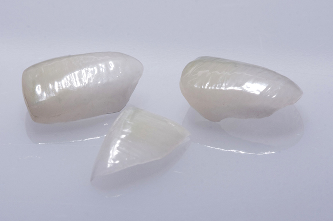 Step 7 The result prior to placement of the veneers. Step 7 The result prior to placement of the veneers.