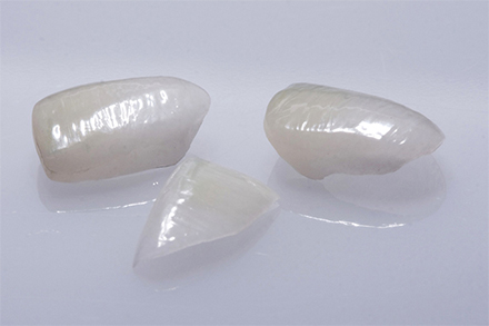 Step 7 The result prior to placement of the veneers. Step 7 The result prior to placement of the veneers.