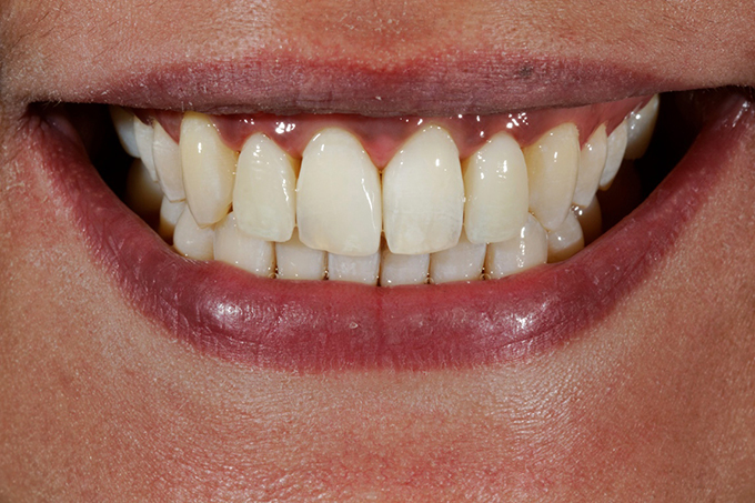 Step 9 End result Step 9 End result