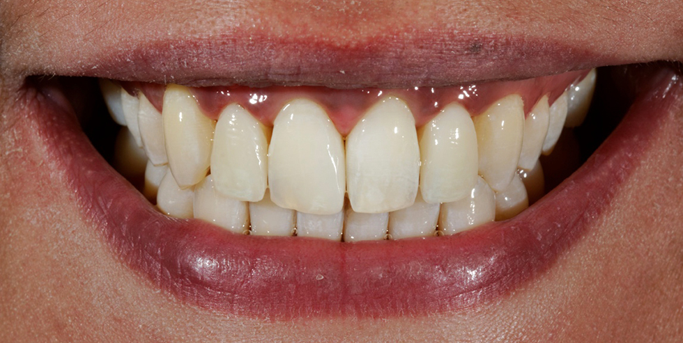 Masterpiece Dr. Gerhard Werling 3 Masterpiece Dr. Gerhard Werling 3