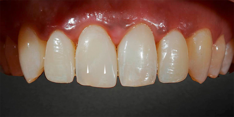 Masterpiece Dr. Gerhard Werling 1 Masterpiece Dr. Gerhard Werling 1