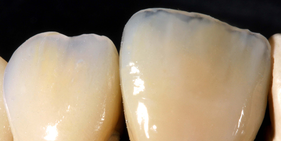 Masterpiece J&uuml;rgen Freitag