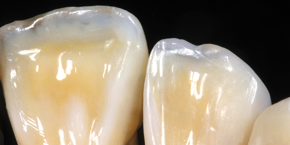 Masterpiece J&uuml;rgen Freitag 2