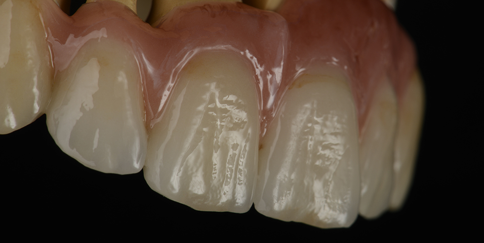 Masterpiece Bj&ouml;rn Czappa 3