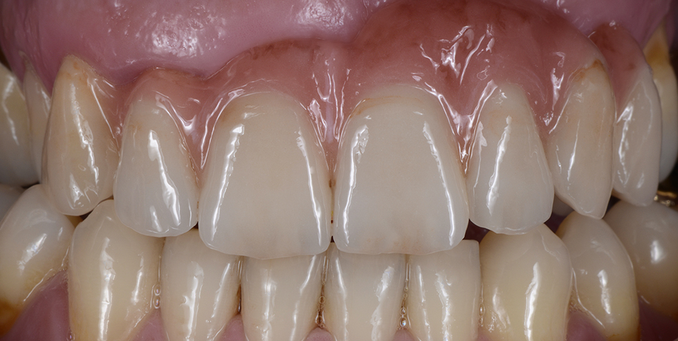 Masterpiece Bj&ouml;rn Czappa 2