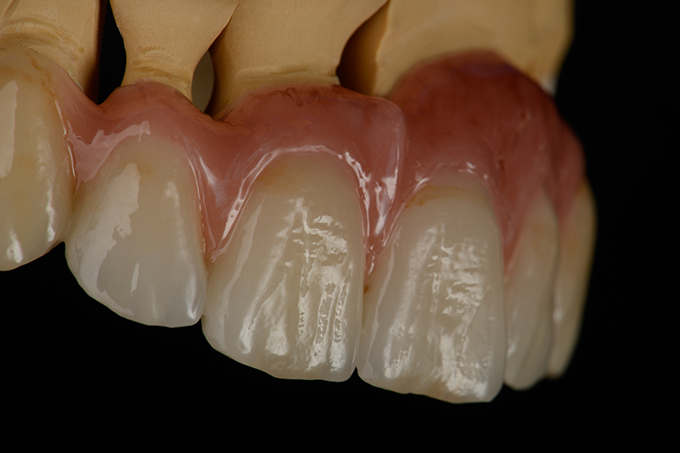 Oberfl&auml;chen-Textur