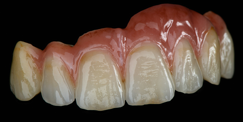 Masterpiece Bj&ouml;rn Czappa