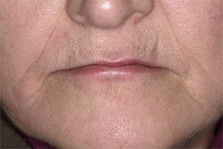 Step 1 Initial situation Step 1 Initial situation