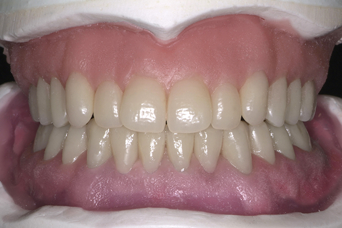 Step 9 End result Step 9 End result