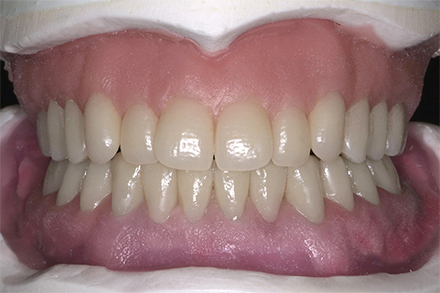 Step 9 End result Step 9 End result