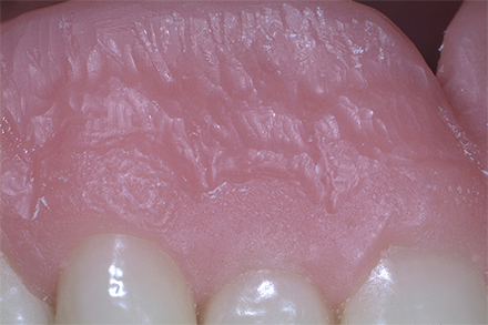 Step 9 End result Step 9 End result